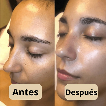 Luxe Piel™ - Black Rice Peel Shot | Transforma y Sublima Tu Piel